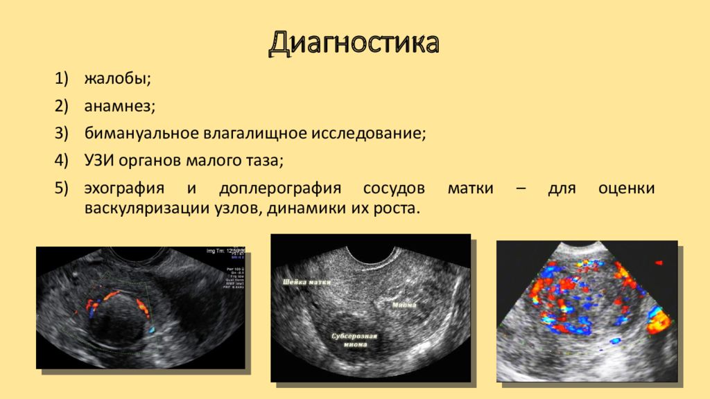 Бимануальное влагалищное исследование