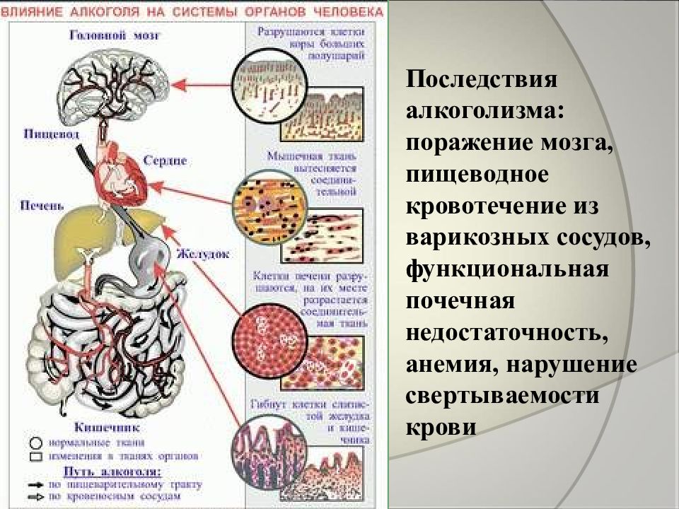 Вред алкоголя схема