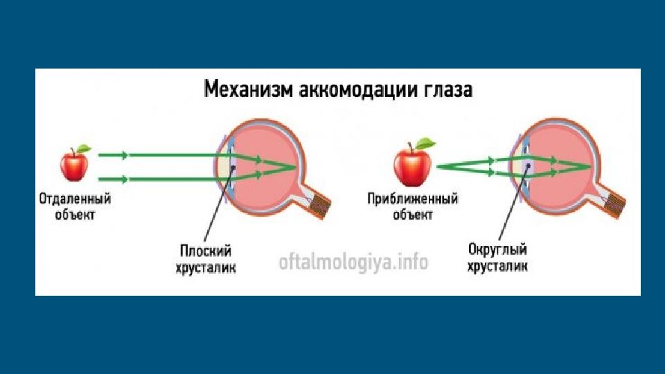 Механизм аккомодации презентация