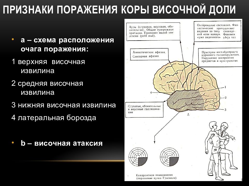 Нарушение схемы тела возникает при поражении