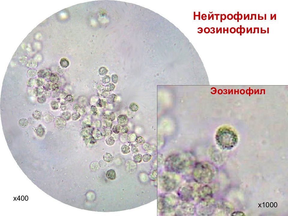 Микроскопия осадка мочи фото