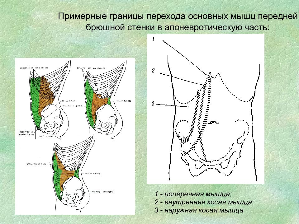 Грыжи передней брюшной стенки у детей презентация