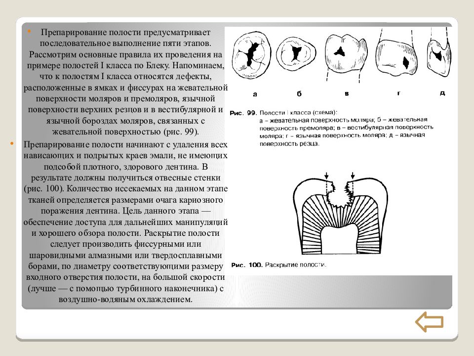 Препарирование полости. Этапы препарирования 1 класса. Принципы препарирования кариозных полостей по Лукомскому. Препарирование по 1 классу Блэка этапы. Препарирование полости 1 класса.