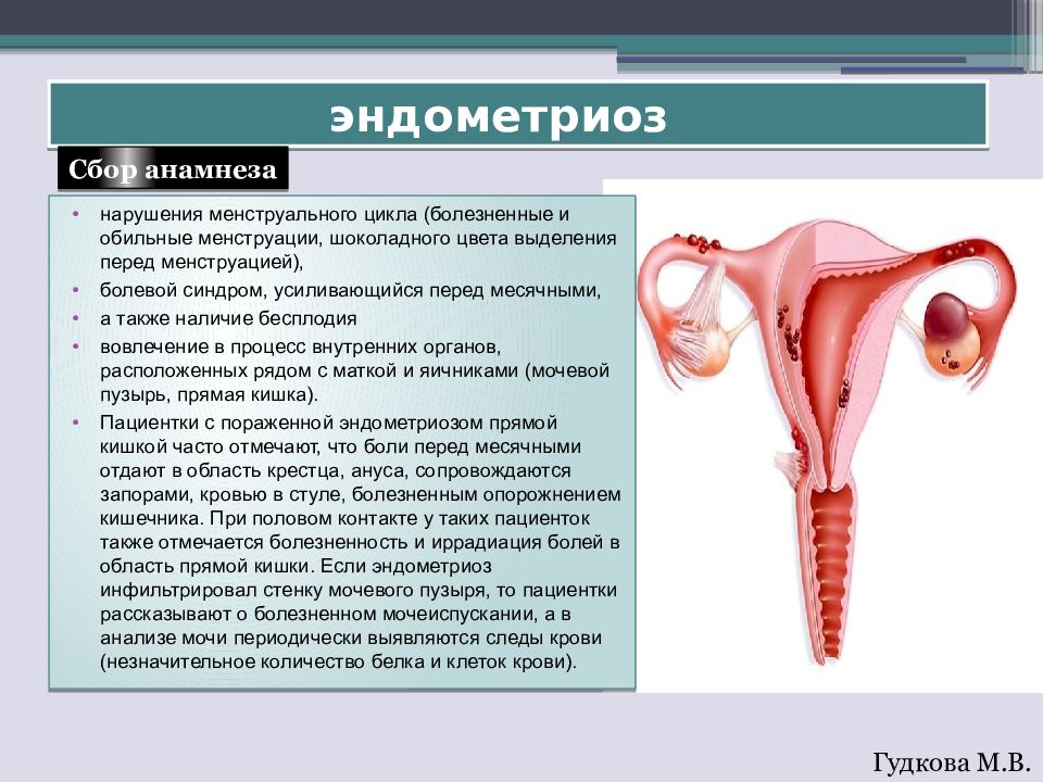 Месячные при эндометриозе. Болезненные менструации. Эндометриоз. Эндометриоз менструационного цикла. Эндометриоз и нарушение менструационного цикла. Выделения при эндометриоз.