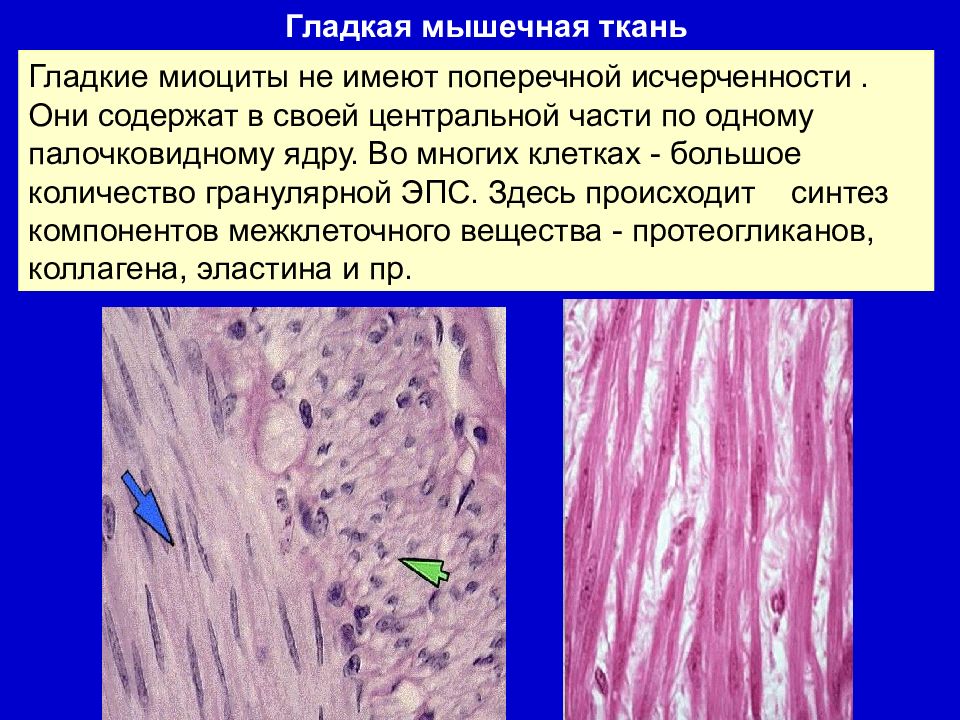 Гладкая мышечная. Межклеточное вещество гладкой мышечной ткани. Строение гладкой мышечной ткани межклеточное вещество. Гладкая мышечная ткань, гладкие миоциты. Исчерченность мышечной ткани.