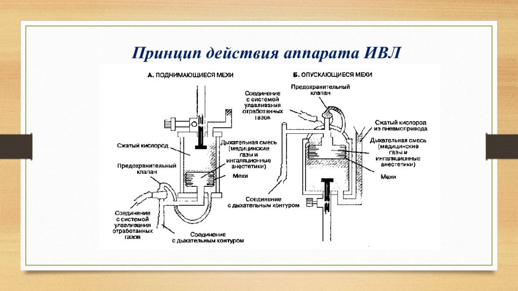 Искусственная вентиляция схема