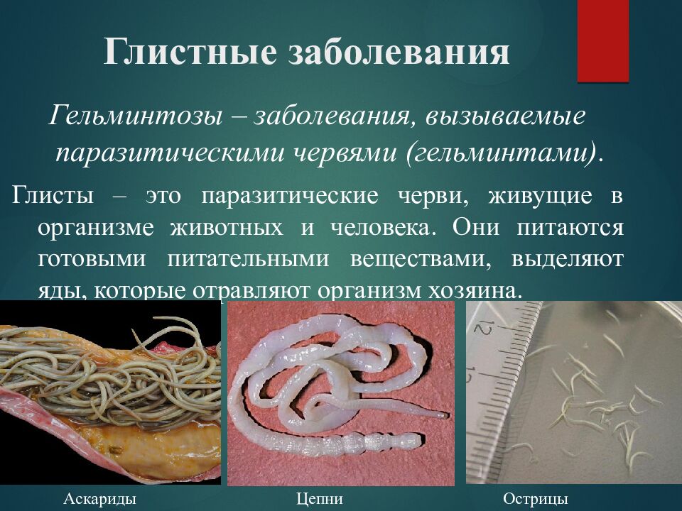 Глистные заболевания