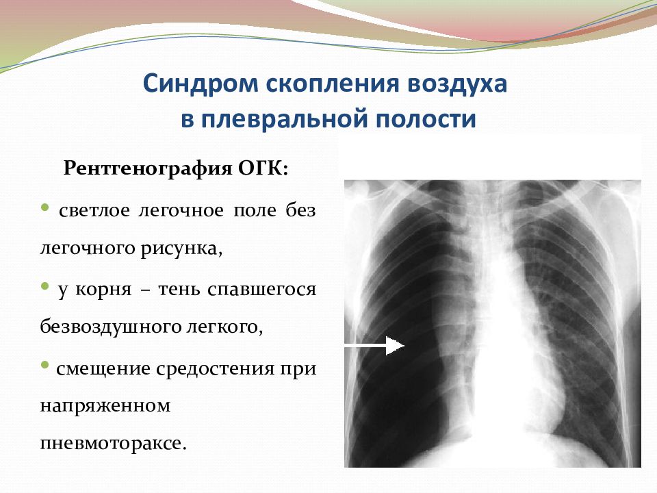 Объясните почему на рентгеновском снимке изображение газа в плевральной полости черное