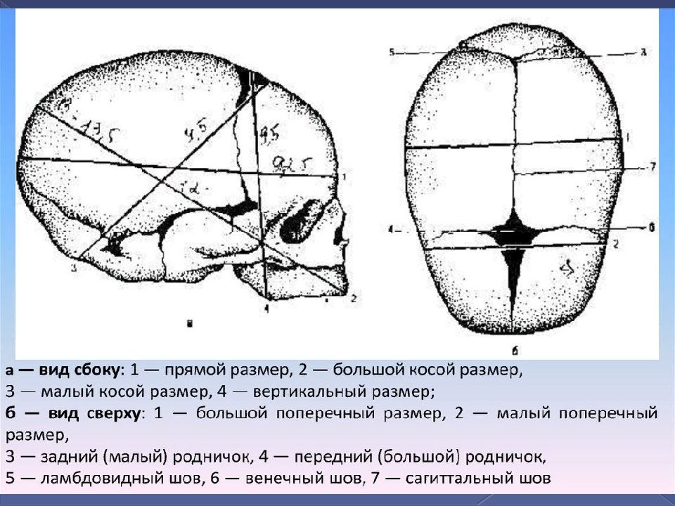 Прямой размер головки плода. Большой поперечный размер головки плода. Средний косой размер головки плода. Средний косой размер головки. Малый косой размер головки.