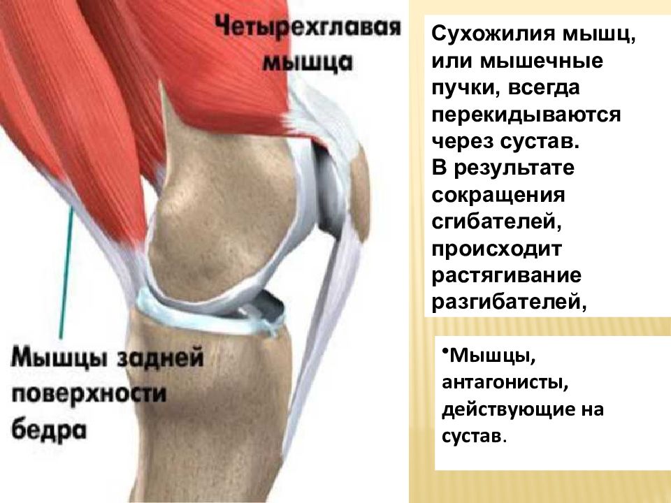 Явление изображенное на рисунке возникает при непродолжительном растяжение четырехглавой