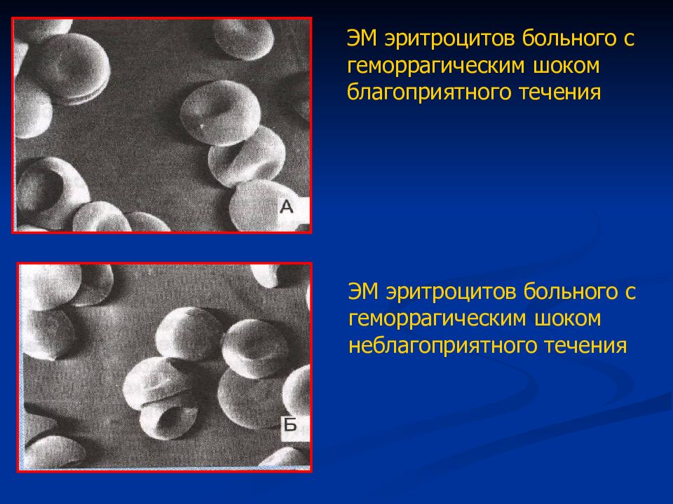 Паразиты поражающие эритроциты. Эритроциты курильщика. Гибель эритроцитов фото. Овальные образования эритроцитах.