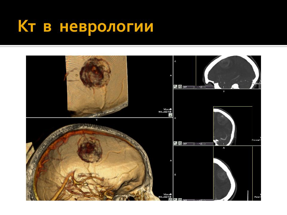 Презентация на тему компьютерная томография