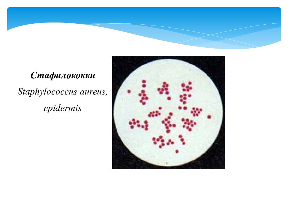 Золотистый стафилококк презентация микробиология