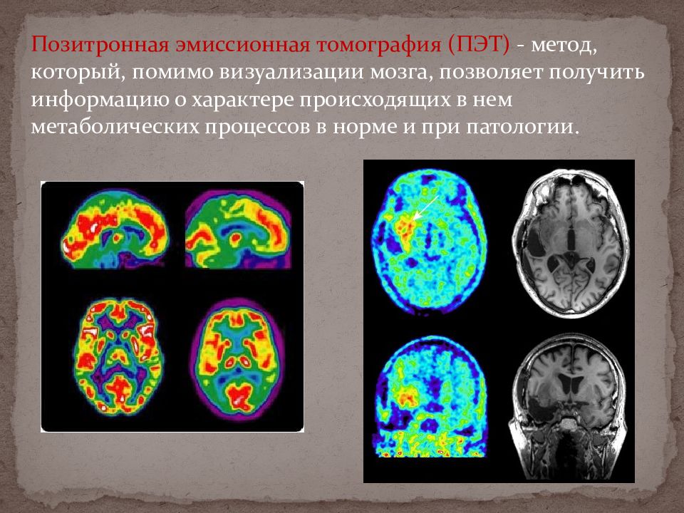 Кт и мрт презентация