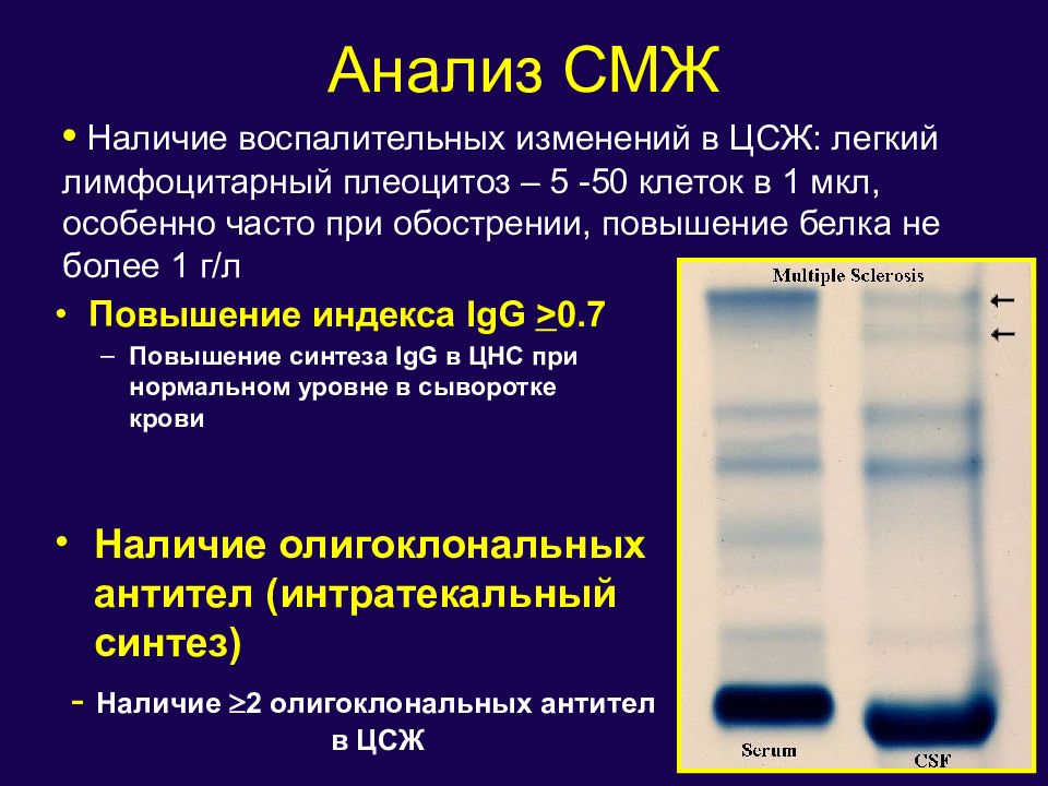 Заболевания цнс презентация