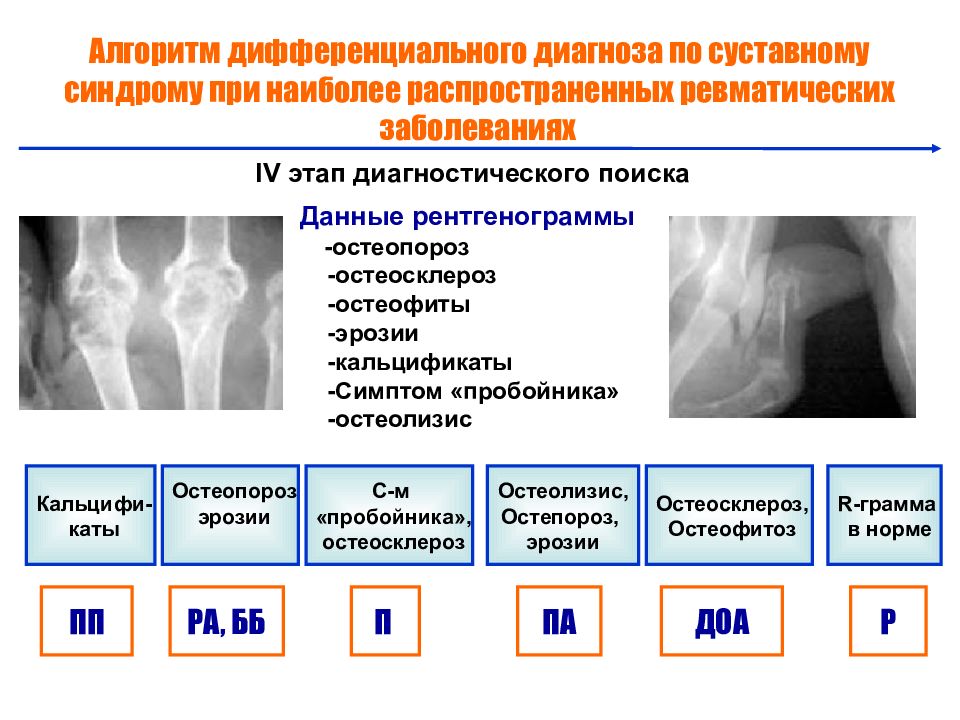 Артриту нет форум. Ревматоидный артрит диагностика. Ревматоидный артрит презентация. Дифференциальная диагностика суставного синдрома. Ревматоидный артрит диагноз.