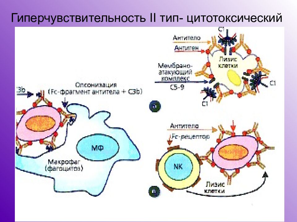 Типы гиперчувствительности. Реакция гиперчувствительности 2 типа. Реакция гиперчувствительности 2 типа механизм. Гиперчувствительность немедленного типа 2. Гиперчувствительность немедленного типа 2 Тип.