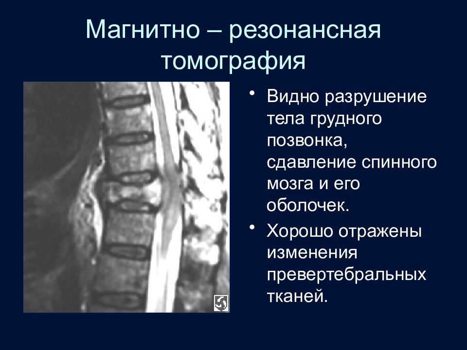 Методы исследования спинного мозга презентация