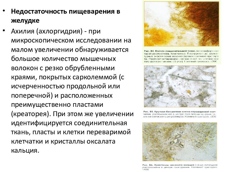 Растительная неперевариваемая клетчатка в кале у взрослого. Соединительная ткань в Кале. Мышечные волокна без исчерченности в Кале. Соединительно тканевые волокна в Кале. Соединительная ткань в Кале микроскопия.