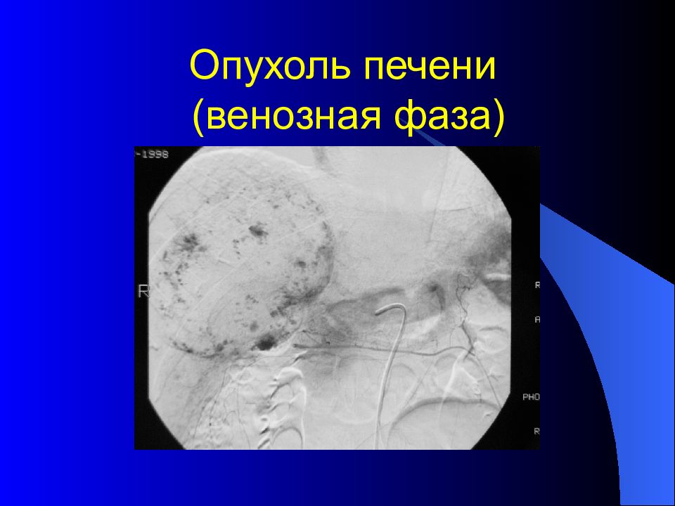 Лучевая диагностика брюшной полости презентация