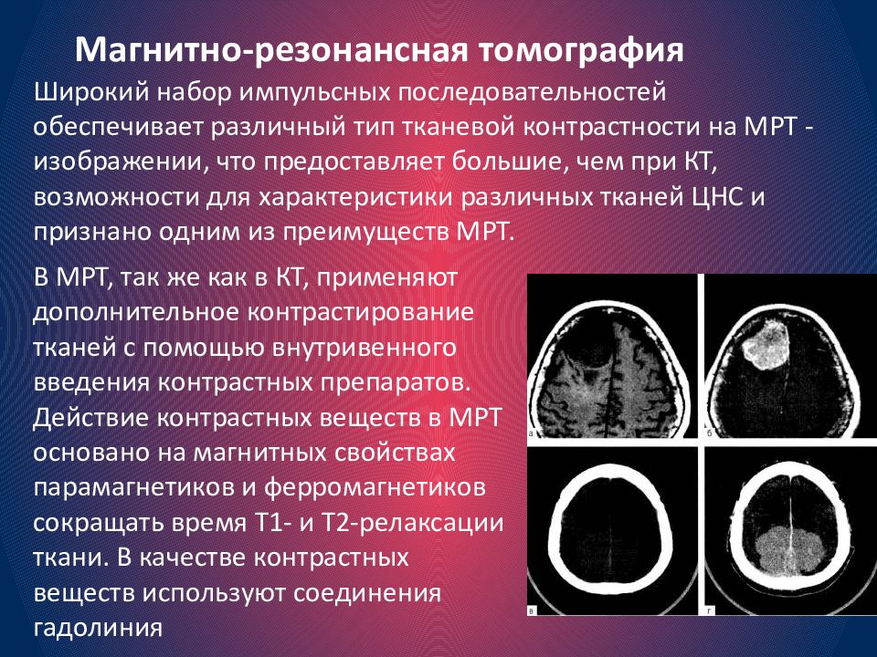 Методы исследования в неврологии презентация