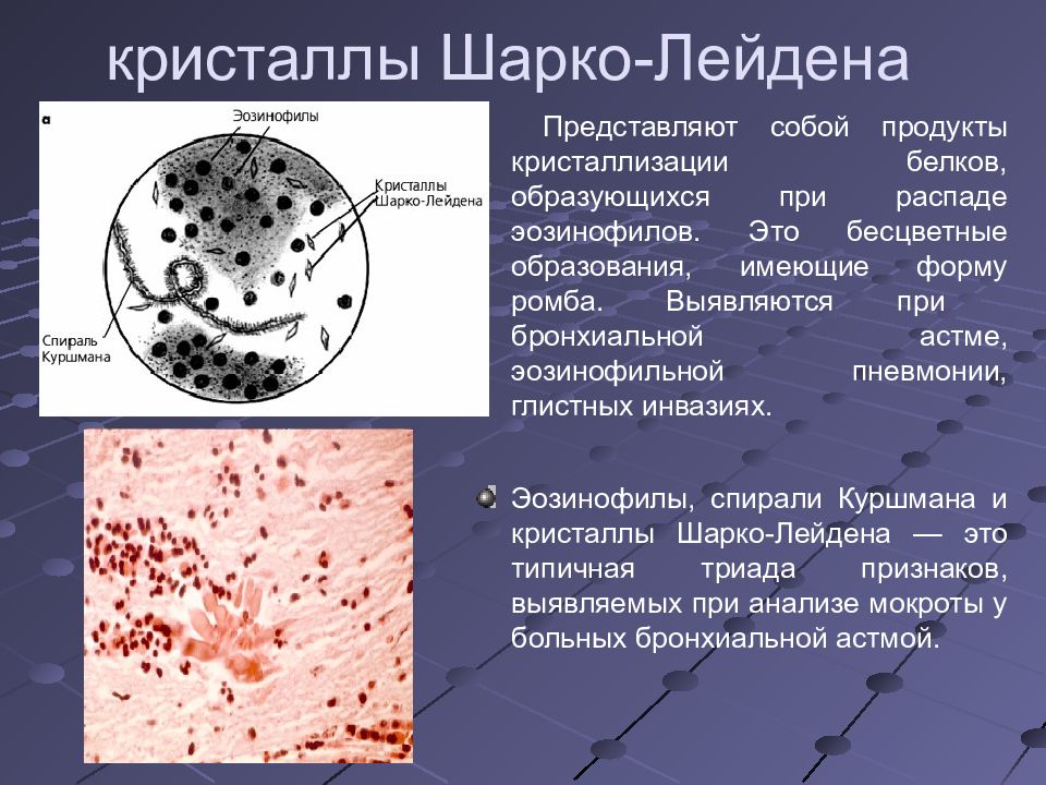 Микроскопия мокроты в картинках с описанием