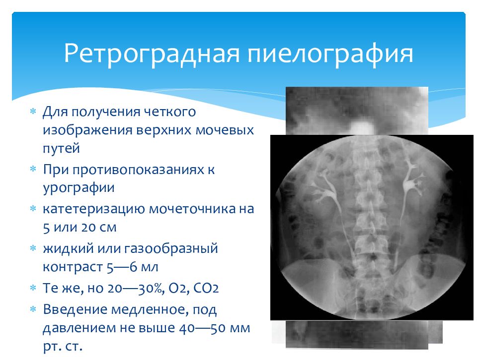 Лучевая диагностика почек презентация