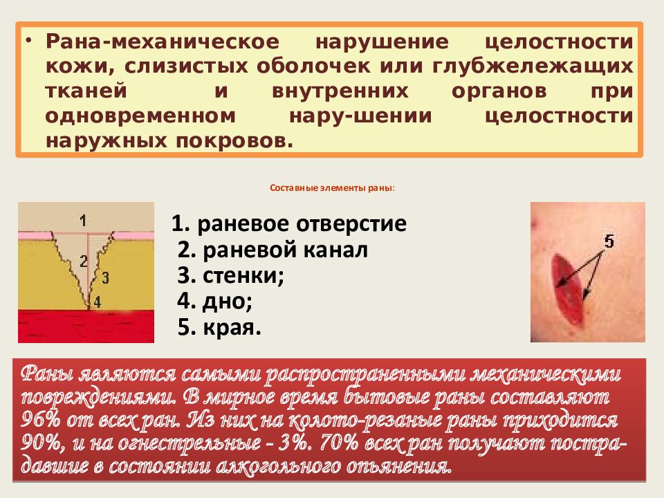 Признаки колото резаного