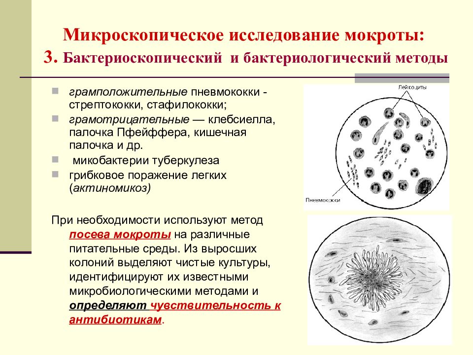 Исследование микроскопической картины мокроты