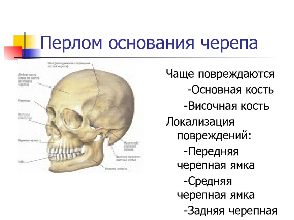 Основание черепа картинка