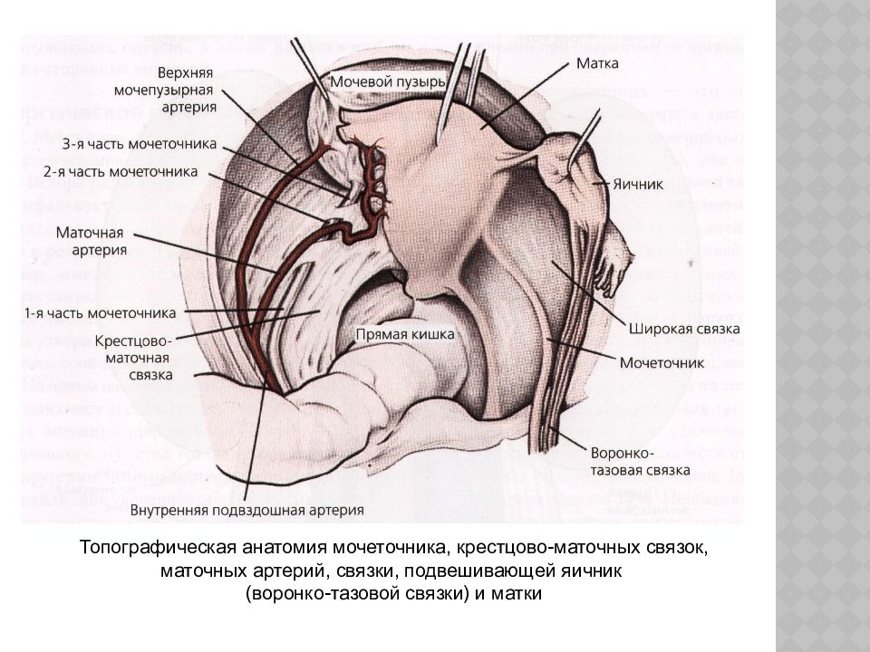 Связка подвешивающая яичник. Связки матки топографическая анатомия. Воронко тазовая связка матки. Маточная артерия анатомия. Связочный аппарат матки анатомия.