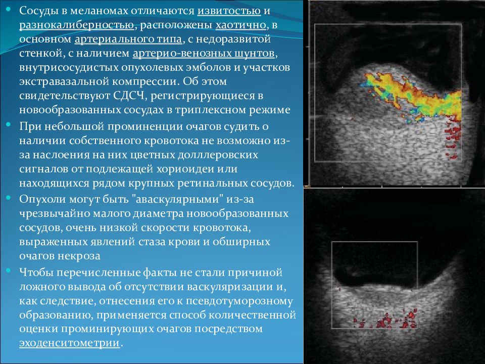 Дифференциальная диагностика меланомы. Дифференциальная диагностика меланомы хориоидеи. Меланома дифференциальный диагноз. Инвазия по Кларку меланома.