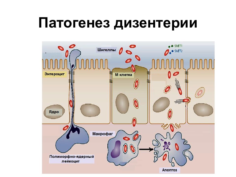 Дизентерия презентация эпидемиология