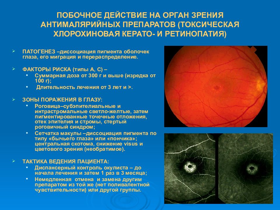 Болезни органов зрения. Патологии органов зрения. Поражение органов зрения. Патология органа зрения при общих заболеваниях организма. Изменения органа зрения при общих заболеваниях.