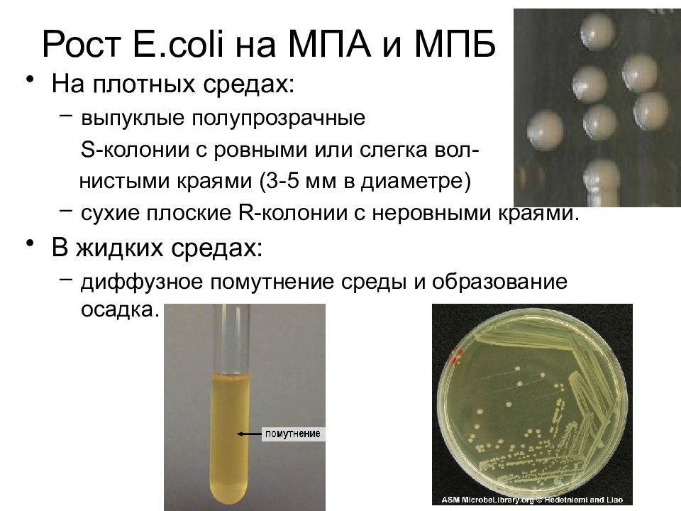Характер роста бактерий. Е coli плотных питательных средах. МПБ питательная среда. МПБ микробиология. МБА среда микробиология.