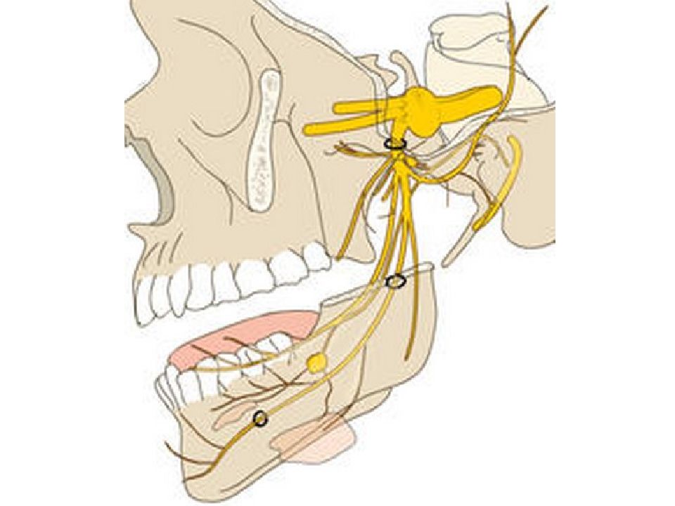 Нижнечелюстной нерв. Ушно височный нерв. Нижнечелюстной и язычный нерв. Менингеальная ветвь нижнечелюстного нерва. Нижнечелюстной нерв тройничного нерва.