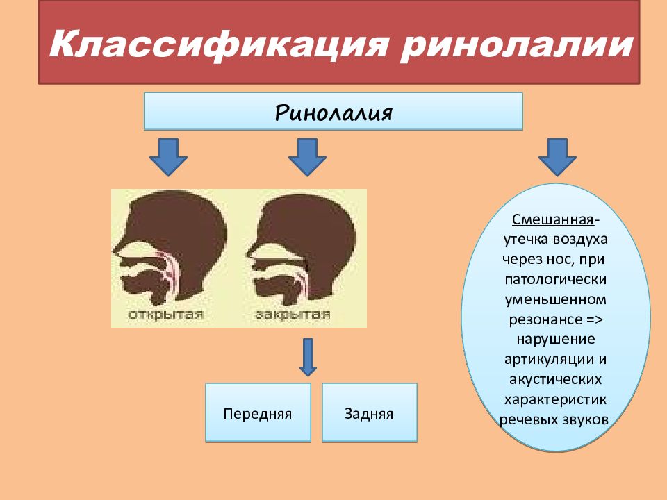 Начала говорить в нос