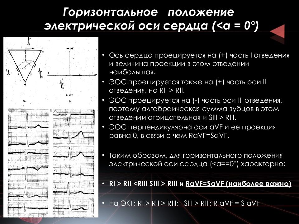 Определение осей сердца