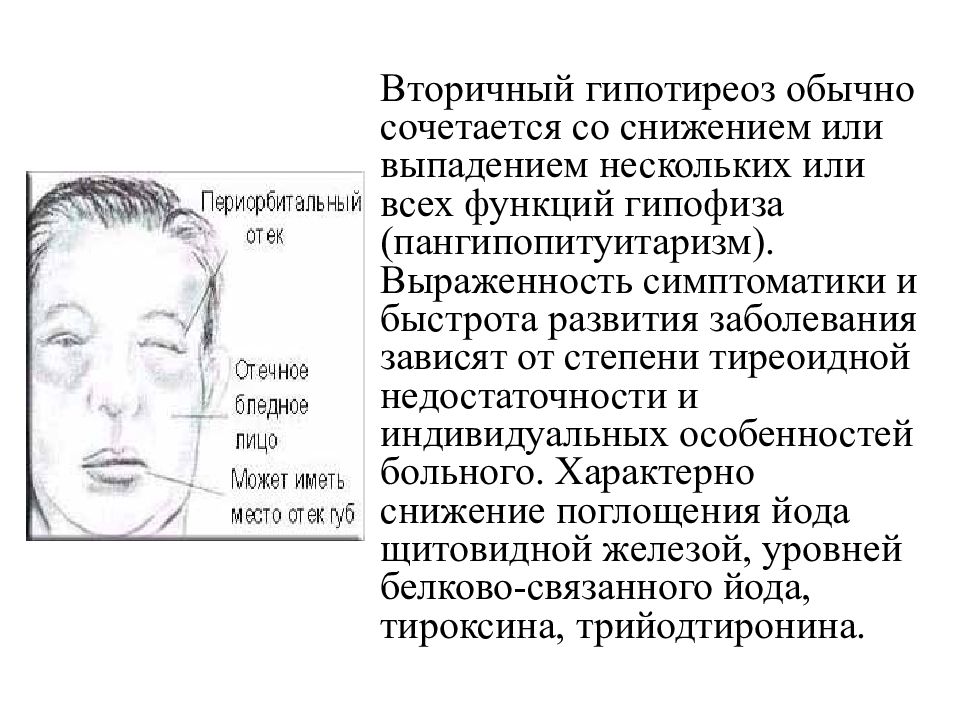 Вторичный гипотиреоз презентация