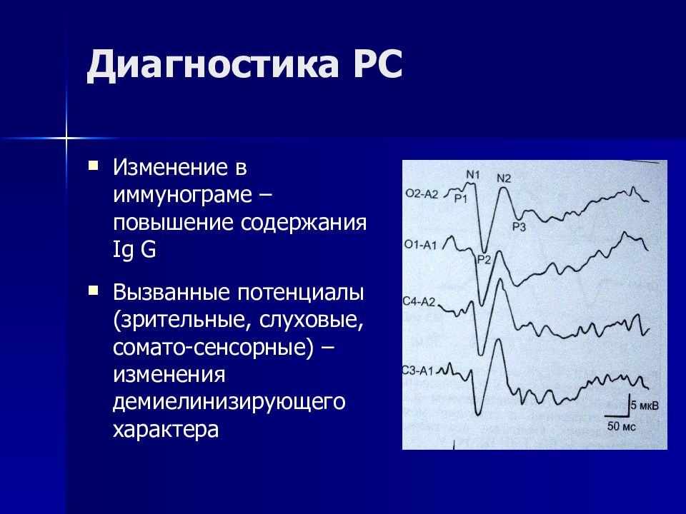 Вызванный исследования. Зрительные вызванные потенциалы. Вызванные потенциалы при рассеянном склерозе. Зрительные вызванные потенциалы при рассеянном склерозе. Рассеянный склероз диагностика.