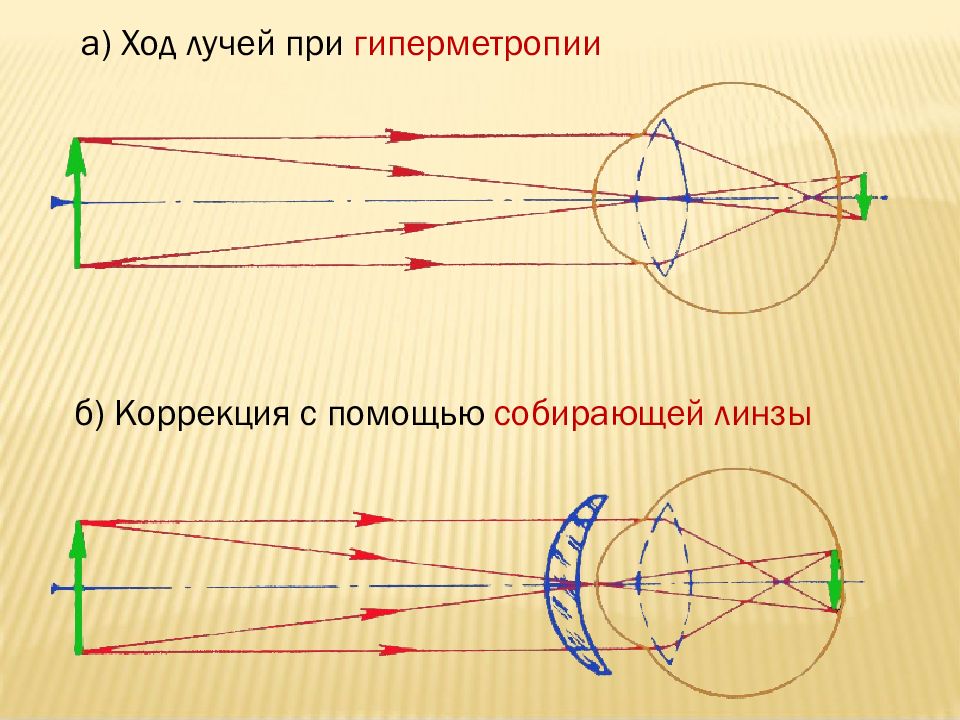 Ход лучей в глазу человека