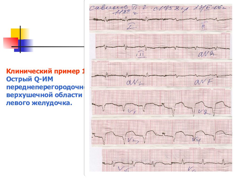 Ибс пропедевтика внутренних болезней презентация