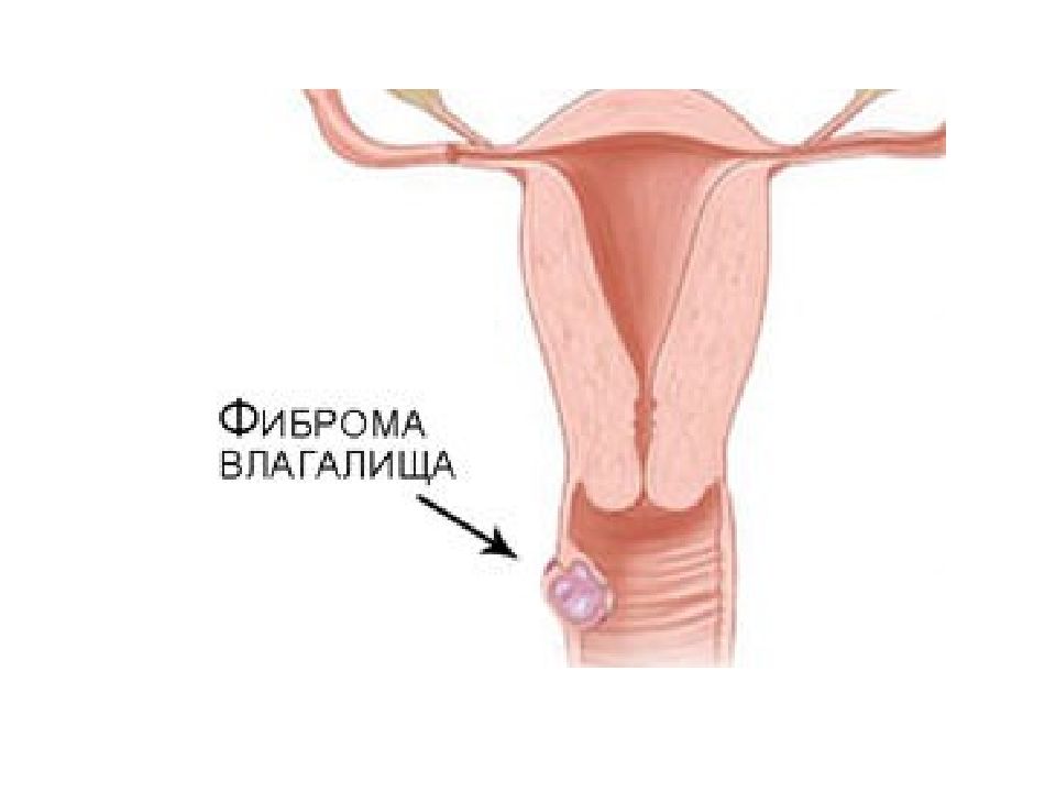 Половые Губы Внутри Фото