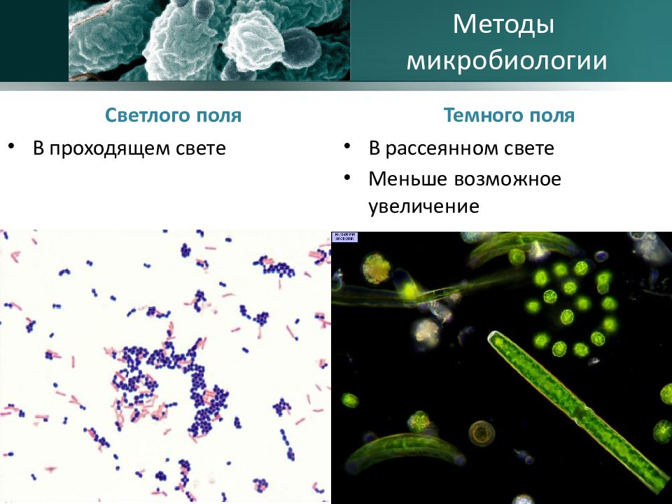 В методе темного поля микроскопии изображение объекта получается