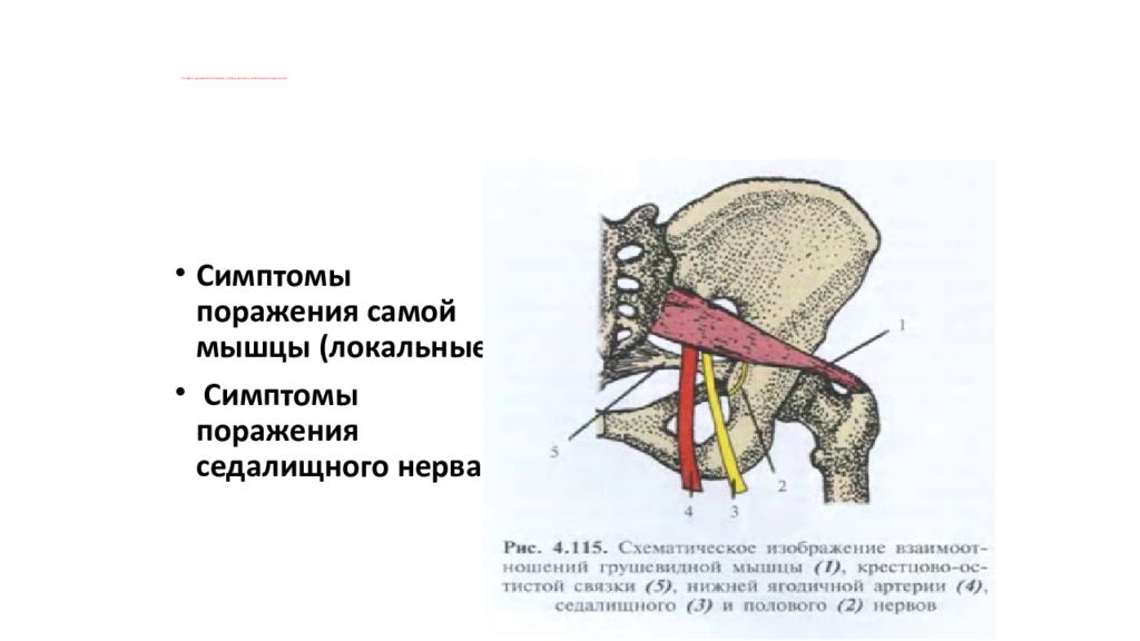 Грушевидная мышца нерв