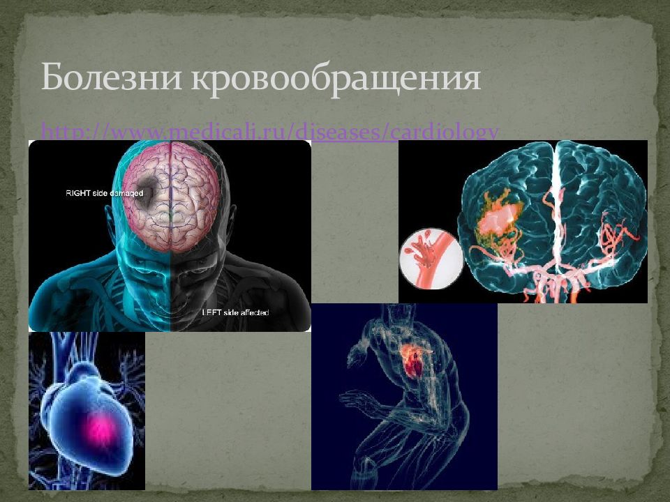 Болезни кровообращения. Заболевания кровообращения. Болезни кровоснабжения. Заболевания кровообращения список. Циркуляция болезней.