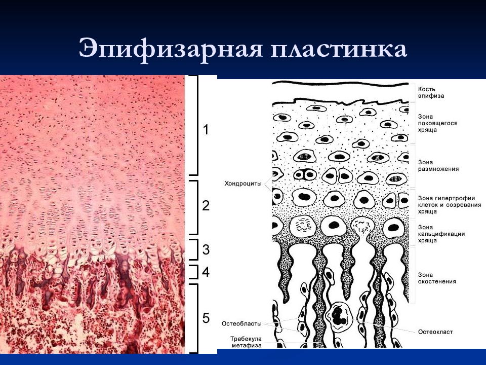 Эпифизарный хрящ. Эпифизарная пластинка. Эпифизарные пластинки являются. Эпифизарные пластины.