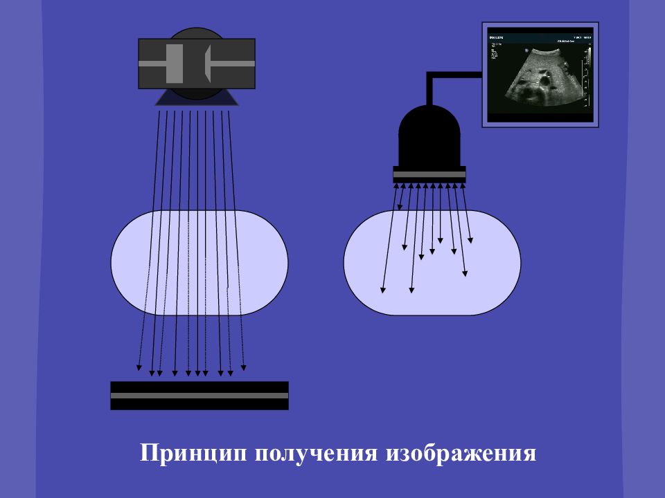 Для получения изображений в ультразвуковых сканерах используются