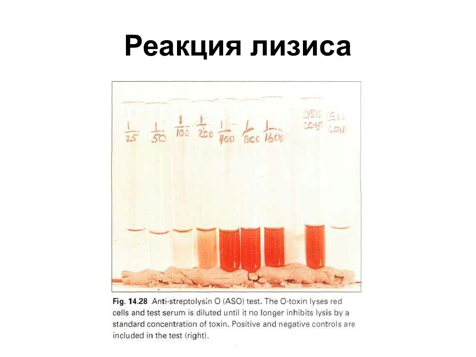 Реакция иммунного гемолиза. Реакция иммунного лизиса компоненты. Реакция иммунного лизиса иммунология. Реакции лизиса (РСК, реакция бактериолиза, реакция иммобилизации, рал). Реакция иммунного бактериолиза.