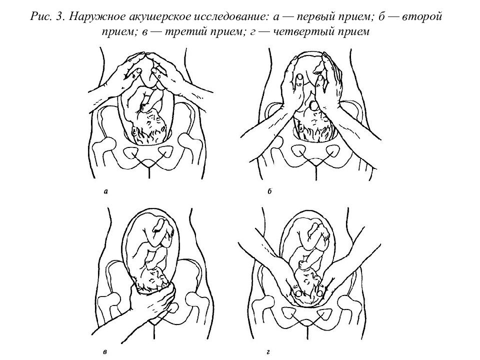 В 3 4 приема